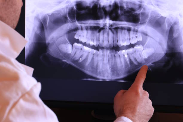 Best Emergency Treatment for Dental Infections or Abscesses in Escatawpa, MS